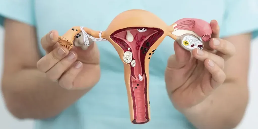 Curso CFC Oncología Ginecológica